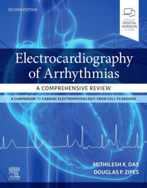 Elsevier UK Electrocardiography of Arrhythmias: A Comprehensive Review