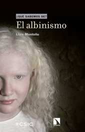 El albinismo, Lluis Montoliu - Catarata