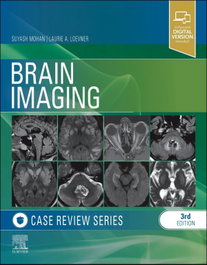 ELSEVIER UK Brain imaging:case review series (3rd Edition)