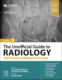 ELSEVIER UK The unofficial guide to radiology: 100 practice abdominal x-rays
