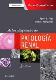ELSEVIER EDITORIAL ATLAS DIAGNÓSTICO DE PATOLOGÍA RENAL, Agnes Fogo; Michael Kashgarian