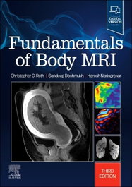 Fundamentals of Body MRI, AA.VV. - ELSEVIER UK