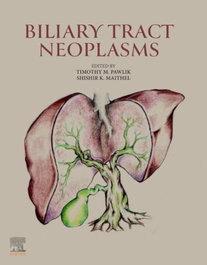 ELSEVIER UK Biliary Tract Neoplasms
