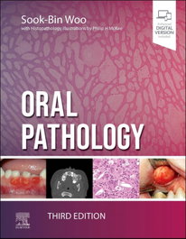ELSEVIER UK Oral pathology, Woo - ELSEVIER UK