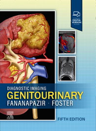 Diagnostic imaging: genitourinary, AA.VV. - ELSEVIER UK
