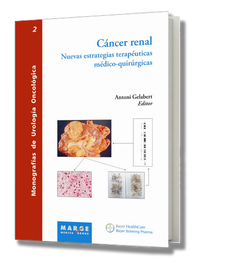 Cáncer renal, Antoni Gelabert Mas - MARGE BOOKS