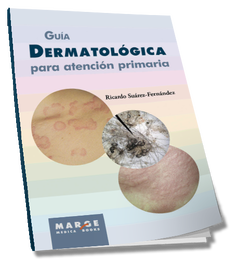 MARGE BOOKS, Guía dermatológica para atención primaria - Suárez Fernández, Ricardo
