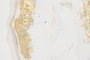 DKD Home Decor Cuadro Lienzo MDF Flor Surtido de 2 Piezas 82,5x82,5 cm