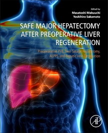 ACADEMIC PRESS Safe major hepatectomy after preoperative liver regeneratio