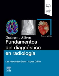 Elsevier Editorial Grainger y Allison. Fundamentos Diagnóstico Radiología