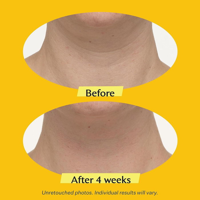 Strivectin TL ADVANCED TIGHTENING Crema Reafirmante para Cuello y Escote 50 ml Strivectin TL ADVANCED TIGHTENING Crema Reafirmante para Cuello y Escote 50 ml
