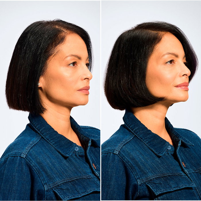 Redken ACIDIC GROW FULL SYSTEM Sérum para Cuero Cabelludo y Cabello 190 ml