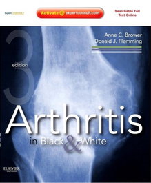 Arthritis in Black and White, Anne Brower - ELSEVIER UK
