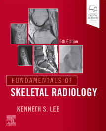 ELSEVIER UK FUNDAMENTALS OS SKELETAL RADIOLOGY