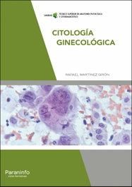 PARANINFO, Citología ginecológica - Martínez Girón, Rafael