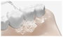 Xiaomi Puntas de Repuesto para Water Flosser (4 unidades)