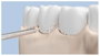 Xiaomi Puntas de Repuesto para Water Flosser (4 unidades)