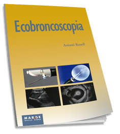 MARGE BOOKS ECOBRONCOSCOPIA
