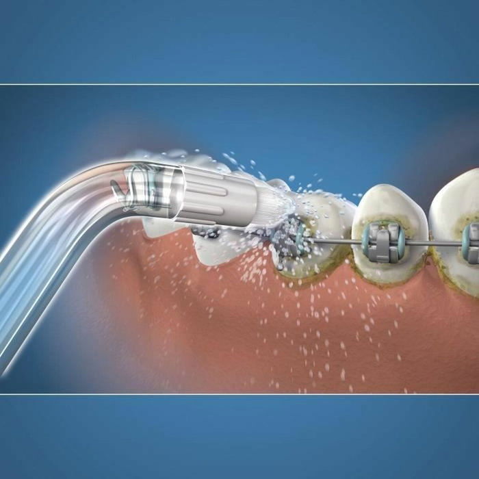 Waterpik Punta de irrigador dental para ortodoncia y aparatos dentales especiales