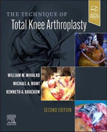 ELSEVIER UK THE TECHNIQUE OF TOTAL KNEE ARTHROPLASTY 2ND EDITION