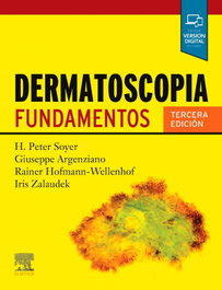 Elsevier Editorial, Dermatoscopia, 3ª Ed. - Soyer, H. Peter