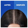 Head & Shoulders Hairfall Defense Champú Anticaída y Anticaspa Fortalecedor para Cabello Débil y Cuidado Diario 1000 ml
