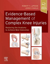 ELSEVIER UK Evidence-based management of complex knee injuries