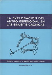 LC, La exploración del antro esfenoidal en las sinusitis crónicas