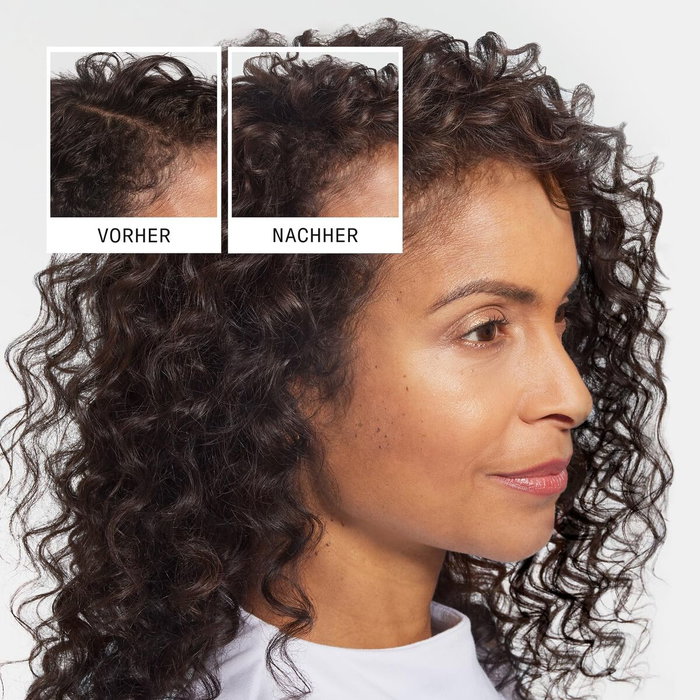 Champú Anticaída Nioxin Anti-Hairloss 475 ml Champú Anticaída Nioxin Anti-Hairloss 475 ml