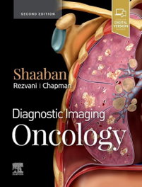 ELSEVIER UK Diagnostic Imaging: Oncology (2nd Edition)