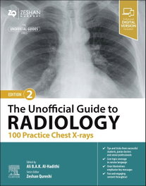 ELSEVIER UK Unofficial guide to radiology: 100 practice chest x-rays