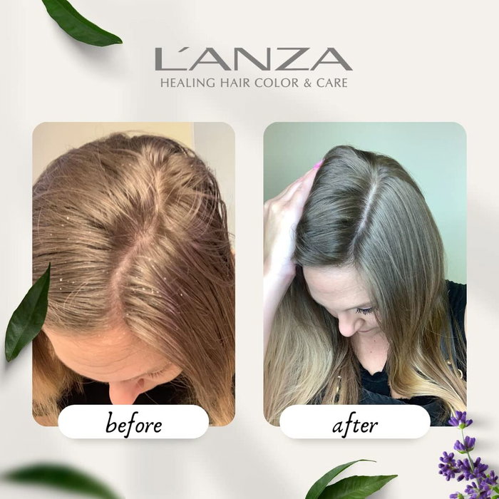 LANZA Tratamiento Equilibrante Cuero Cabelludo 100 ml LANZA Tratamiento Equilibrante Cuero Cabelludo 100 ml