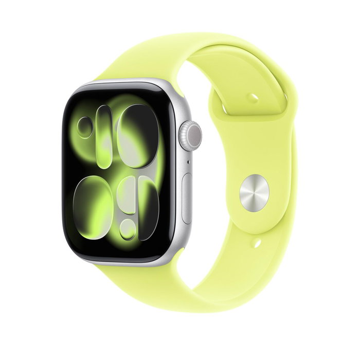 Apple Correa Apple Watch Grupo de rock Amarillo