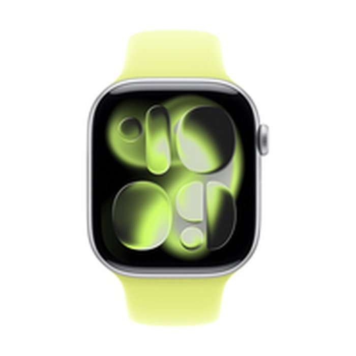 Apple Correa Apple Watch Grupo de rock Amarillo