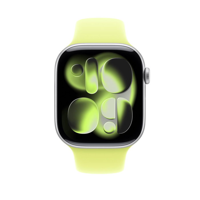 Apple Correa Apple Watch Grupo de rock Amarillo