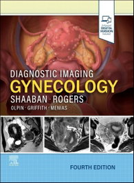 Diagnostic imaging:gynecology, AA.VV. - ELSEVIER UK