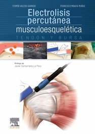 ELSEVIER EDITORIAL, Electrolisis percutánea musculoesquelética. Tendón y bursa