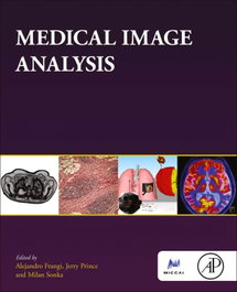 ACADEMIC PRESS Medical image analysis