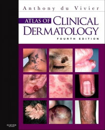 ELSEVIER UK Atlas of Clinical Dermatology