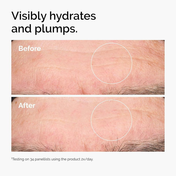 The Ordinary Hyaluronic Acid 2% + B5 Sérum 30 ml The Ordinary Hyaluronic Acid 2% + B5 Sérum 30 ml