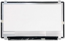 CoreParts Panel LCD Original 15,6" FHD IPS 1920x1080 Brillante, Gama de Color 72%, Conector 30 Pines Abajo a la Derecha, Incluye 4 Brackets