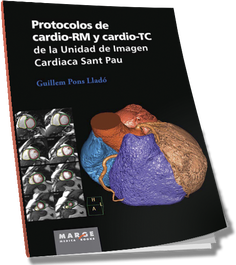 Protocolos de cardio-RM y cardio-TC, PONS LLADO, GUILLEM - MARGE BOOKS