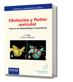 MARGE BOOKS Fibrilación y flutter auricular