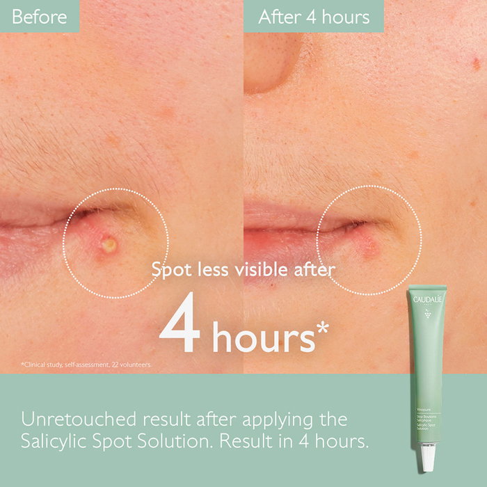 Caudalie VINOPURE stop granos salicílico Tratamiento Acné, Poros y puntos negros 15 ml