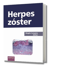 MARGE BOOKS, Herspes Zoster, Magda Campins