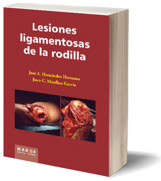 MARGE BOOKS Lesiones ligamentosas de la rodilla