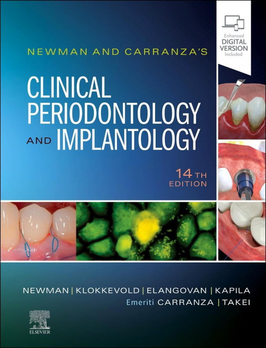 Newman and Carranza's Clinical Periodontology Implantology, Newman/Klokkevold/Elangovan/Kapila - SAUNDERS