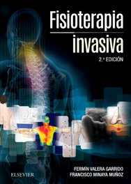 Fisioterapia invasiva, Fermín Valera Garrido, Francisco Minaya Muñoz - ELSEVIER EDITORIAL