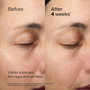 Shiseido Future Solution LX Crema Regeneradora de Contorno de Ojos y Labios 17 ml