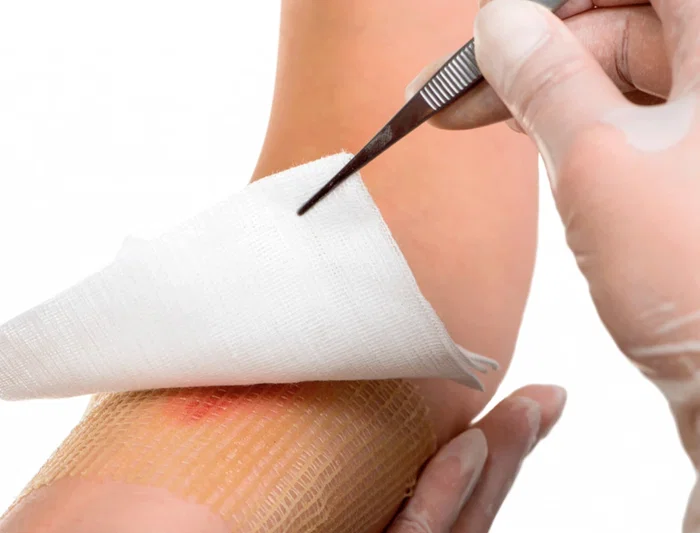 Gasa Estéril Algodón Hidrófilo Libre de Gérmenes, No Desprende Filamentos, Absorción Óptima Caja 100 Unidades